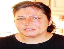 Yağ'dan haşlandı